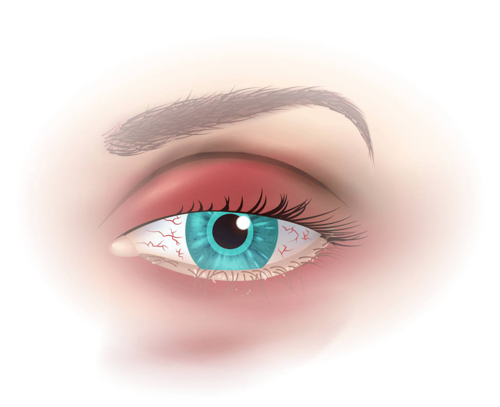 Diagnostic en analyse clinique